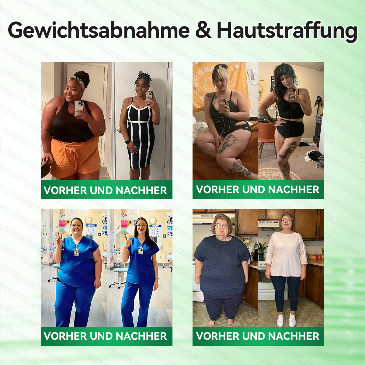 🇩🇪𝐎𝐟𝐟𝐢𝐳𝐢𝐞𝐥𝐥𝐞𝐫 𝐒𝐡𝐨𝐩 |   🌻🌻𝑮𝑳𝑶𝐑𝐄𝐍𝐃𝘼®𝙈𝙤𝙧𝙞𝙣𝗴𝗮 · 𝗕𝗲𝗿𝗯𝗲𝗿𝒊𝒏 × 𝑵𝘼𝘿+ 10-𝙞𝙣-𝟏 𝐀𝐝𝐯𝐚𝗻𝗰𝗲𝗱 𝗡𝗮𝙣𝙤 𝙈𝙞𝙠𝙧𝐨𝐧𝐚𝐝𝐞𝐥-𝐏𝐚𝒕𝒄𝗵(𝐍𝐮𝐫 𝐞𝐢𝐧𝐦𝐚𝐥 𝐭ä𝐠𝐥𝐢𝐜𝐡, 𝐬𝐢𝐜𝐡𝐭𝐛𝐚𝐫𝐞 𝐕𝐞𝐫ä𝐧𝐝𝐞𝐫𝐮𝐧𝐠𝐞𝐧 𝐢𝐧 𝟕 𝐓𝐚𝐠𝐞𝐧)✅ 𝐅ü𝐫 𝐅𝐞𝐭𝐭𝐥𝐞𝐢𝐛𝐢𝐠𝐤𝐞𝐢𝐭, 𝐇𝐚𝐮𝐭𝐬𝐭𝐫𝐚𝐟𝐟𝐮𝐧𝐠, 𝐃𝐢𝐚𝐛𝐞𝐭𝐞𝐬, 𝐒𝐜𝐡𝐥𝐚𝐟𝐚𝐩𝐧𝐨𝐞, 𝐆𝐞𝐥𝐞𝐧𝐤𝐩𝐫𝐨𝐛𝐥𝐞𝐦𝐞 𝐮𝐧𝐝 𝐦𝐞𝐡𝐫!
