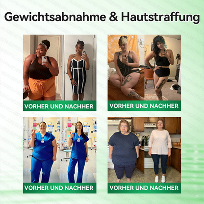 🇩🇪𝐎𝐟𝐟𝐢𝐳𝐢𝐞𝐥𝐥𝐞𝐫 𝐒𝐡𝐨𝐩 |   🌻🌻𝑮𝑳𝑶𝐑𝐄𝐍𝐃𝘼®𝙈𝙤𝙧𝙞𝙣𝗴𝗮 · 𝗕𝗲𝗿𝗯𝗲𝗿𝒊𝒏 × 𝑵𝘼𝘿+ 10-𝙞𝙣-𝟏 𝐀𝐝𝐯𝐚𝗻𝗰𝗲𝗱 𝗡𝗮𝙣𝙤 𝙈𝙞𝙠𝙧𝐨𝐧𝐚𝐝𝐞𝐥-𝐏𝐚𝒕𝒄𝗵(𝐍𝐮𝐫 𝐞𝐢𝐧𝐦𝐚𝐥 𝐭ä𝐠𝐥𝐢𝐜𝐡, 𝐬𝐢𝐜𝐡𝐭𝐛𝐚𝐫𝐞 𝐕𝐞𝐫ä𝐧𝐝𝐞𝐫𝐮𝐧𝐠𝐞𝐧 𝐢𝐧 𝟕 𝐓𝐚𝐠𝐞𝐧)✅ 𝐅ü𝐫 𝐅𝐞𝐭𝐭𝐥𝐞𝐢𝐛𝐢𝐠𝐤𝐞𝐢𝐭, 𝐇𝐚𝐮𝐭𝐬𝐭𝐫𝐚𝐟𝐟𝐮𝐧𝐠, 𝐃𝐢𝐚𝐛𝐞𝐭𝐞𝐬, 𝐒𝐜𝐡𝐥𝐚𝐟𝐚𝐩𝐧𝐨𝐞, 𝐆𝐞𝐥𝐞𝐧𝐤𝐩𝐫𝐨𝐛𝐥𝐞𝐦𝐞 𝐮𝐧𝐝 𝐦𝐞𝐡𝐫!