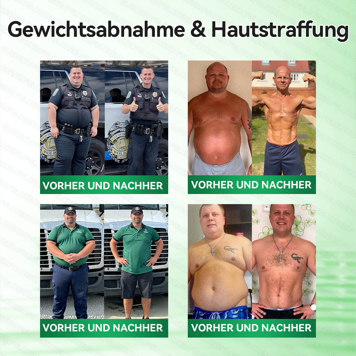 🇩🇪𝐎𝐟𝐟𝐢𝐳𝐢𝐞𝐥𝐥𝐞𝐫 𝐒𝐡𝐨𝐩 |   🌻🌻𝑮𝑳𝑶𝐑𝐄𝐍𝐃𝘼®𝙈𝙤𝙧𝙞𝙣𝗴𝗮 · 𝗕𝗲𝗿𝗯𝗲𝗿𝒊𝒏 × 𝑵𝘼𝘿+ 10-𝙞𝙣-𝟏 𝐀𝐝𝐯𝐚𝗻𝗰𝗲𝗱 𝗡𝗮𝙣𝙤 𝙈𝙞𝙠𝙧𝐨𝐧𝐚𝐝𝐞𝐥-𝐏𝐚𝒕𝒄𝗵(𝐍𝐮𝐫 𝐞𝐢𝐧𝐦𝐚𝐥 𝐭ä𝐠𝐥𝐢𝐜𝐡, 𝐬𝐢𝐜𝐡𝐭𝐛𝐚𝐫𝐞 𝐕𝐞𝐫ä𝐧𝐝𝐞𝐫𝐮𝐧𝐠𝐞𝐧 𝐢𝐧 𝟕 𝐓𝐚𝐠𝐞𝐧)✅ 𝐅ü𝐫 𝐅𝐞𝐭𝐭𝐥𝐞𝐢𝐛𝐢𝐠𝐤𝐞𝐢𝐭, 𝐇𝐚𝐮𝐭𝐬𝐭𝐫𝐚𝐟𝐟𝐮𝐧𝐠, 𝐃𝐢𝐚𝐛𝐞𝐭𝐞𝐬, 𝐒𝐜𝐡𝐥𝐚𝐟𝐚𝐩𝐧𝐨𝐞, 𝐆𝐞𝐥𝐞𝐧𝐤𝐩𝐫𝐨𝐛𝐥𝐞𝐦𝐞 𝐮𝐧𝐝 𝐦𝐞𝐡𝐫!